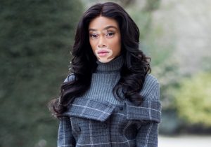 Celebrities Who Have Vitiligo